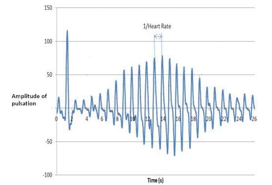 Figure 4 - Oscillometric pulses